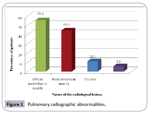 hiv-Pulmonary-radiographic